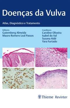 Continuar lendo: Doenças da Vulva: Atlas, Diagnóstico e Tratamento