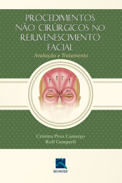 Continuar lendo: Procedimentos não Cirúrgicos no Rejuvenescimento Facial: Avaliação e Tratamento