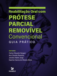 Continuar lendo: Reabilitação oral com prótese parcial removível convencional: guia prático