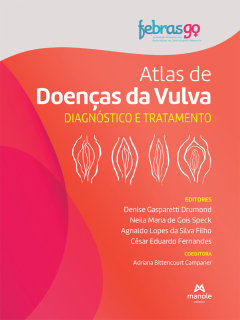 Continuar lendo: Atlas de doenças da vulva: diagnóstico e tratamento