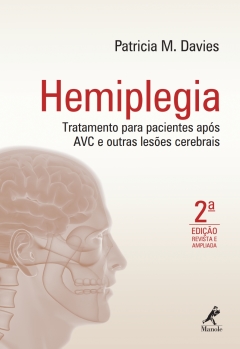 Continuar lendo: Hemiplegia: Tratamento para Pacientes após AVC e Outras Lesões Cerebrais