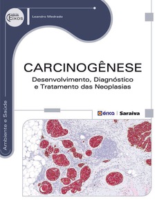 Continuar lendo: Carcinogênese - Desenvolvimento, Diagnóstico e Tratamento das Neoplasias