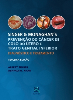 Continuar lendo: Singer e Monaghan's: Prevenção do Câncer de Colo do Útero e  Trato Genital Inferior: Diagnóstico e Tratamento
