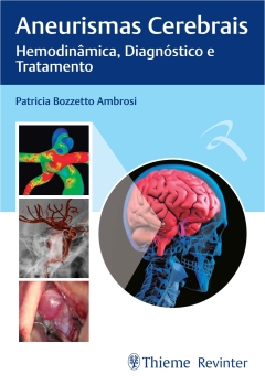 Continuar lendo: Aneurismas Cerebrais: Hemodinâmica, Diagnóstico e Tratamento