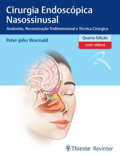 Continuar lendo: Cirurgia Endoscópica Nasossinusal: Anatomia, Reconstrução Tridimensional e Técnica Cirúrgica