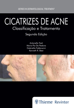 Continuar lendo: Cicatrizes de Acne: Classificação e Tratamento