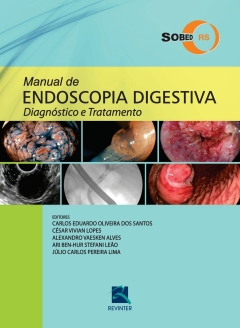 Continuar lendo: Manual de Endoscopia Digestiva: Diagnóstico e Tratamento