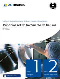 Continuar lendo: Princípios AO do tratamento de fraturas - 2 volumes